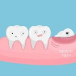 How to tell if wisdom teeth are coming in