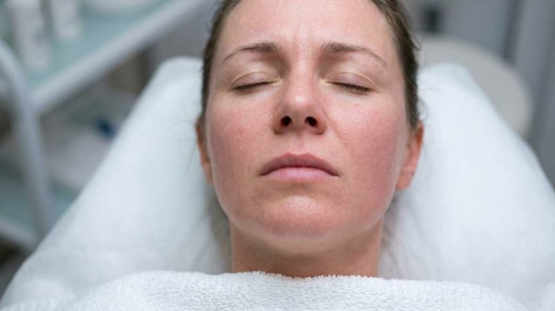 Woman gently soothing irritated skin after a chemical peel spa treatment